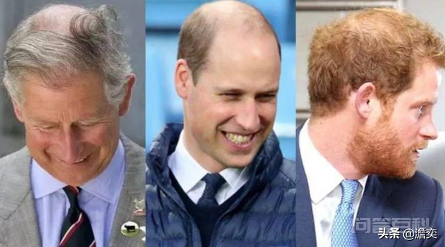 威廉王子的发型一直被各大英媒吐槽，是基因遗传还是英国的水质问题？,第3张